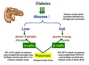 penyebab-diabetes